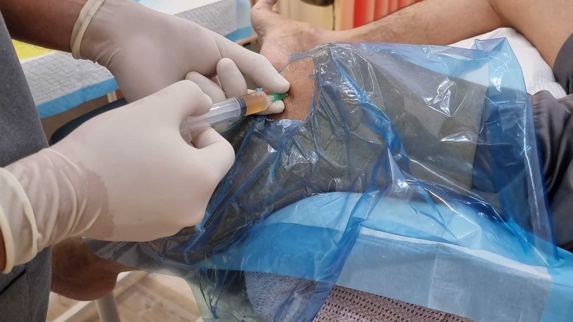 Knee Injections